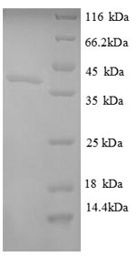 Recombinant Escherichia coli Ornithine carbamoyltransferase subunit F (argF) – Figure 1 of 1