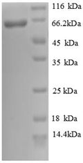 Recombinant Human Cadherin-12 (CDH12), partial – Figure 1 of 1