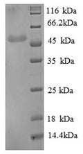 Recombinant Human Beta-enolase (ENO3), partial – Figure 1 of 1