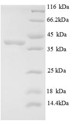 Recombinant Human E3 ubiquitin-protein ligase MIB1 (MIB1), partial – Figure 1 of 1