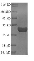 (Tris-Glycine gel) Discontinuous SDS-PAGE (reduced) with 5% enrichment gel and 15% separation gel.
