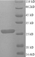 Recombinant Human Zinc finger matrin-type protein 2 (ZMAT2), partial – Figure 1 of 1