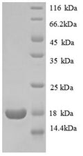 Recombinant Human 60S ribosomal protein L31 (RPL31) – Figure 1 of 1