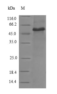 Recombinant Human Vinculin (VCL), partial – Figure 1 of 1
