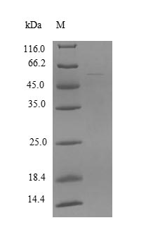 Recombinant Human Zinc finger and SCAN domain-containing protein 21 (ZSCAN21), partial – Figure 1 of 1