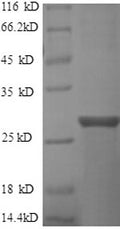 Recombinant Human GTPase ERas (ERAS), partial – Figure 1 of 1