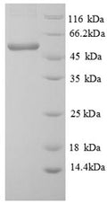 Recombinant Lemna minor ATP synthase subunit beta, chloroplastic (atpB) – Figure 1 of 1