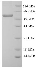 Recombinant Lemna minor ATP synthase subunit beta, chloroplastic (atpB) – Figure 1 of 1