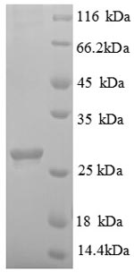 (Tris-Glycine gel) Discontinuous SDS-PAGE (reduced) with 5% enrichment gel and 15% separation gel.