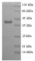 Recombinant Saccharomyces cerevisiae Homocysteine S-methyltransferase 1 (MHT1) – Figure 1 of 1