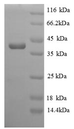 Recombinant Saccharomyces cerevisiae Homocysteine S-methyltransferase 1 (MHT1) – Figure 1 of 1