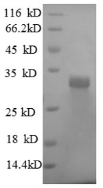 Recombinant Human Laminin subunit beta-2 (LAMB2), partial – Figure 1 of 1