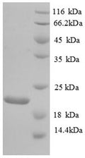 Recombinant Human Urokinase-type plasminogen activator (PLAU), partial – Figure 1 of 1