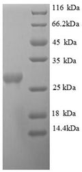 Recombinant Helicobacter pylori Orotidine 5'-phosphate decarboxylase (pyrF) – Figure 1 of 1