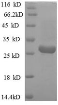 Recombinant Helicobacter pylori Vacuolating cytotoxin autotransporter (vacA), partial – Figure 1 of 1