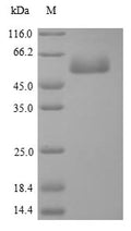 Recombinant Chicken Focal adhesion kinase 1 (PTK2), partial – Figure 1 of 1