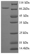 Recombinant Escherichia coli Biosynthetic arginine decarboxylase (speA), partial – Figure 1 of 1