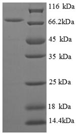 Recombinant Escherichia coli Biosynthetic arginine decarboxylase (speA), partial – Figure 1 of 1