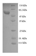 Recombinant Human Zona pellucida sperm-binding protein 3 (ZP3), partial – Figure 1 of 1