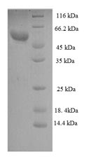Recombinant Human Zona pellucida sperm-binding protein 3 (ZP3), partial – Figure 1 of 1