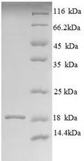 Recombinant Bovine Angiogenin-1 (ANG1) – Figure 1 of 1