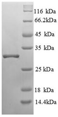 Recombinant Human Glutamyl aminopeptidase (ENPEP), partial – Figure 1 of 1