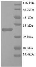 Recombinant Mouse Egl nine homolog 3 protein (Egln3) – Figure 1 of 1