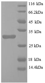 Recombinant Mouse Egl nine homolog 3 protein (Egln3) – Figure 1 of 1