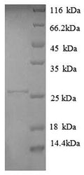 Recombinant Human HLA class II histocompatibility antigen, DP alpha 1 chain (HLA-DPA1), partial – Figure 1 of 1