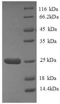 Recombinant Human HLA class II histocompatibility antigen, DQ alpha 2 chain (HLA-DQA2), partial – Figure 1 of 1
