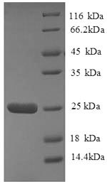 Recombinant Human HLA class II histocompatibility antigen, DQ alpha 2 chain (HLA-DQA2), partial – Figure 1 of 1