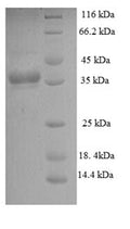 Recombinant Mycobacterium tuberculosis Phosphate-binding protein PstS 1 (pstS1), partial – Figure 1 of 1