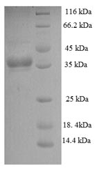 Recombinant Mycobacterium tuberculosis Phosphate-binding protein PstS 1 (pstS1), partial – Figure 1 of 1