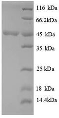 Recombinant Sporosarcina ureae Phenylalanine dehydrogenase (pdh) – Figure 1 of 1