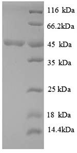 Recombinant Sporosarcina ureae Phenylalanine dehydrogenase (pdh) – Figure 1 of 1
