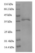 (Tris-Glycine gel) Discontinuous SDS-PAGE (reduced) with 5% enrichment gel and 15% separation gel.