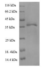 (Tris-Glycine gel) Discontinuous SDS-PAGE (reduced) with 5% enrichment gel and 15% separation gel.