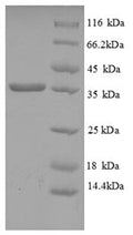 Recombinant Human HLA class I histocompatibility antigen, C alpha chain (HLA-C), partial – Figure 1 of 1