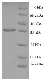 Recombinant Human HLA class I histocompatibility antigen, C alpha chain (HLA-C), partial – Figure 1 of 1