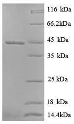 (Tris-Glycine gel) Discontinuous SDS-PAGE (reduced) with 5% enrichment gel and 15% separation gel.