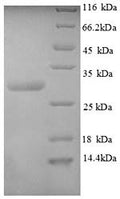 Recombinant Human Calcitonin gene-related peptide 1 (CALCA), partial – Figure 1 of 1