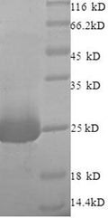 Recombinant Rat Vesicle-fusing ATPase (Nsf), partial – Figure 1 of 1