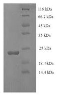 Recombinant Human Caspase-7 (CASP7), partial – Figure 1 of 1