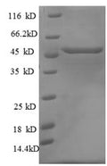 (Tris-Glycine gel) Discontinuous SDS-PAGE (reduced) with 5% enrichment gel and 15% separation gel.