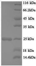 Recombinant Rat GTPase HRas (Hras) – Figure 1 of 1