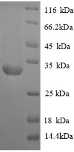 Recombinant Rat Vasopressin V1a receptor (Avpr1a), partial – Figure 1 of 1