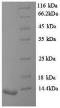 (Tris-Glycine gel) Discontinuous SDS-PAGE (reduced) with 5% enrichment gel and 15% separation gel.