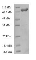 Recombinant Escherichia coli Anaerobic ribonucleoside-triphosphate reductase (nrdD) – Figure 1 of 1