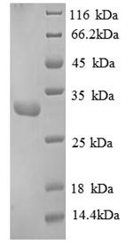 Recombinant Human Replication protein A 30KDA subunit (RPA4), partial – Figure 1 of 1