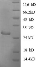 Recombinant Escherichia coli Adenylate kinase (adk) – Figure 1 of 1